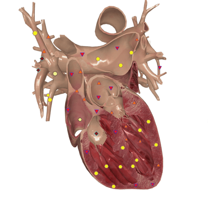 3D Herz NLS Diagnose 2be9b5bb - NLS Diagnostik