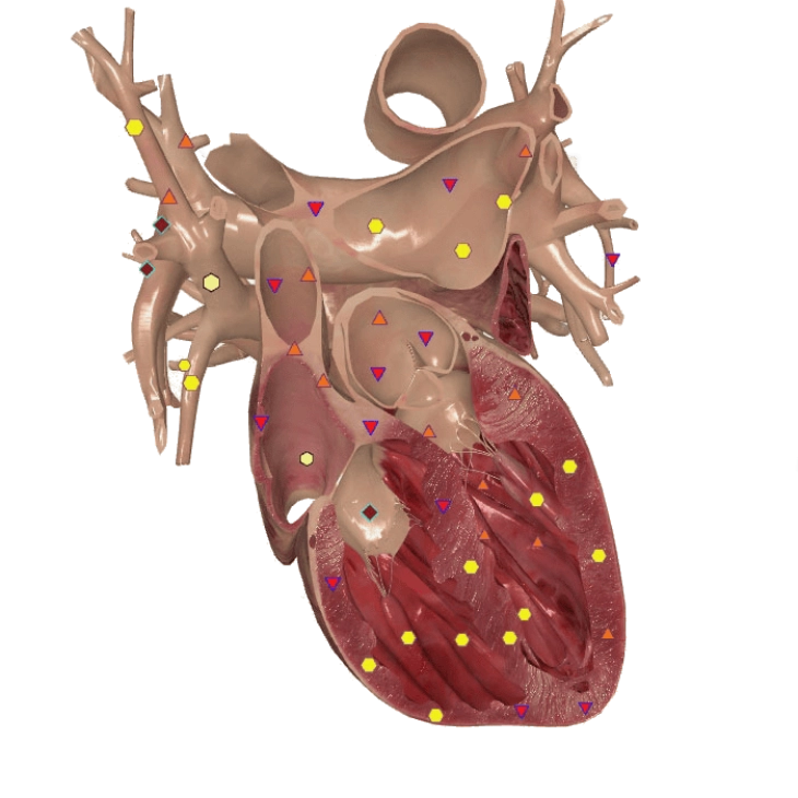 3D Herz NLS Diagnose a49e2a2d - NLS Diagnostik