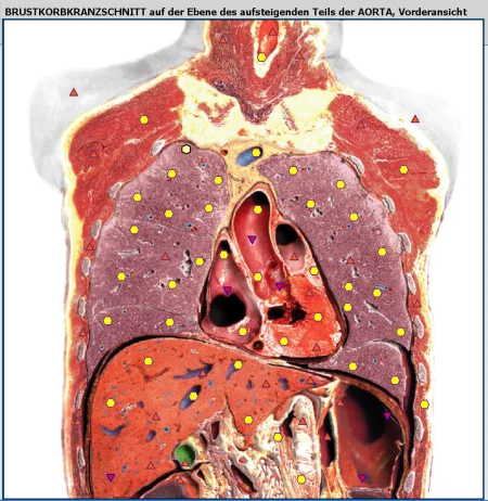 Brustkorb 00297f86 - NLS Diagnostik