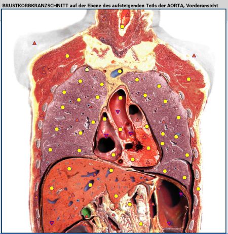 Brustkorb 24b1dfe6 - NLS Diagnostik