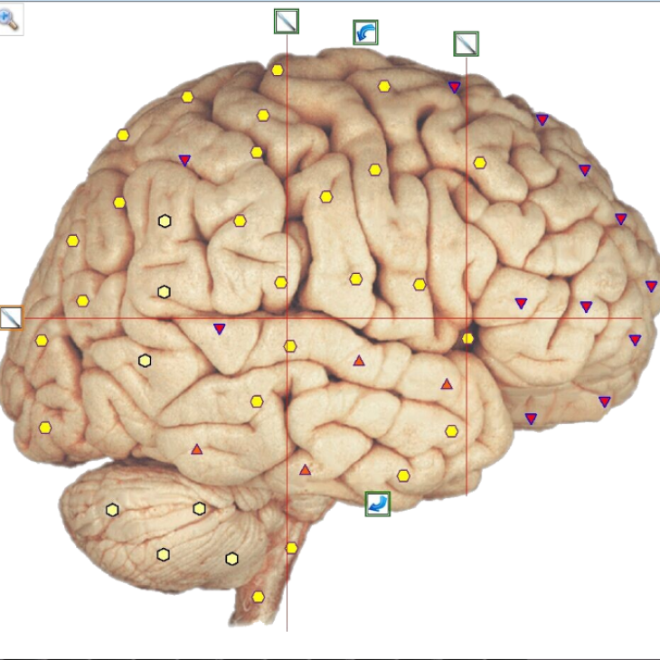 NLS Metatron Diagnostik Gehirn 457be14b - NLS Diagnostik