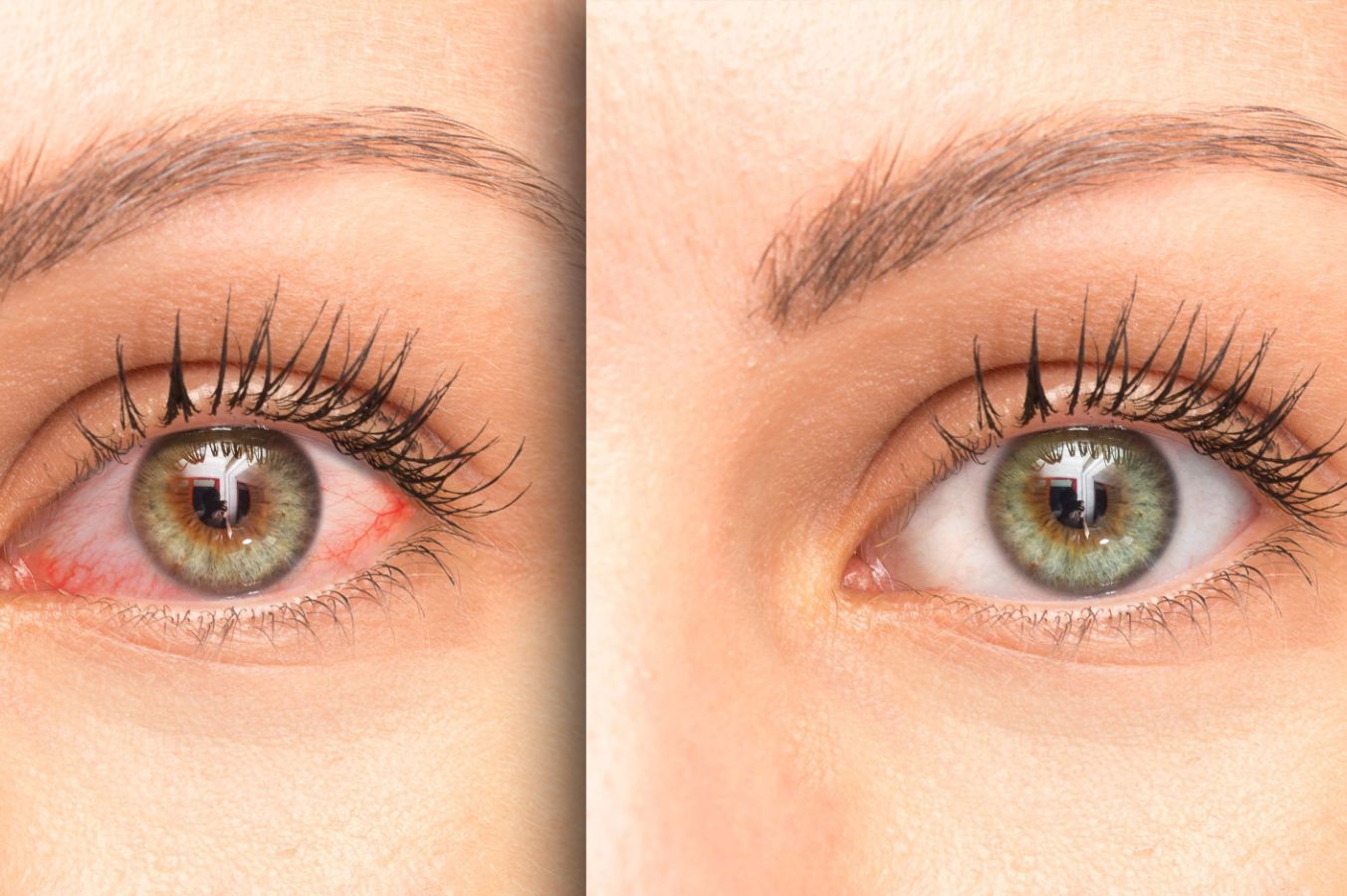 Naet Allergiebehandlung Augsburg b5a30659 - Die Phytotherapie